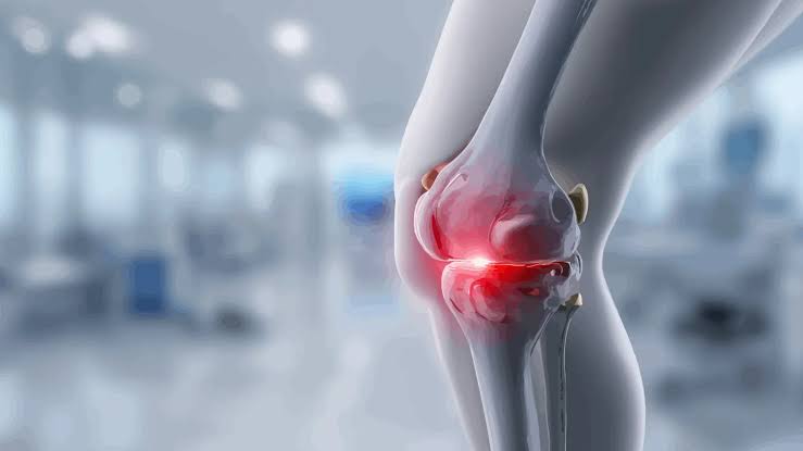 Un nuevo hallazgo médico promete restaurar el cartílago y frenar el deterioro por artrosis en la rodilla
